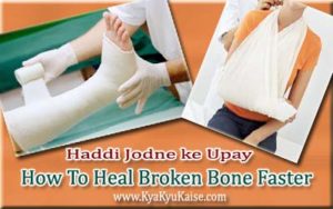 Tuti Haddi Jodne ke Upay, Bone Fracture Treatment in Hindi