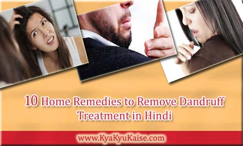 Baalo se Dandruff (russi) Hatane ke Gharelu Upay, Dandruff Treatment in Hindi