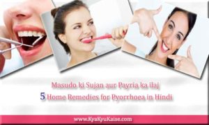 Payria ka ilaj ke upay, Payriya Treatment in Hindi