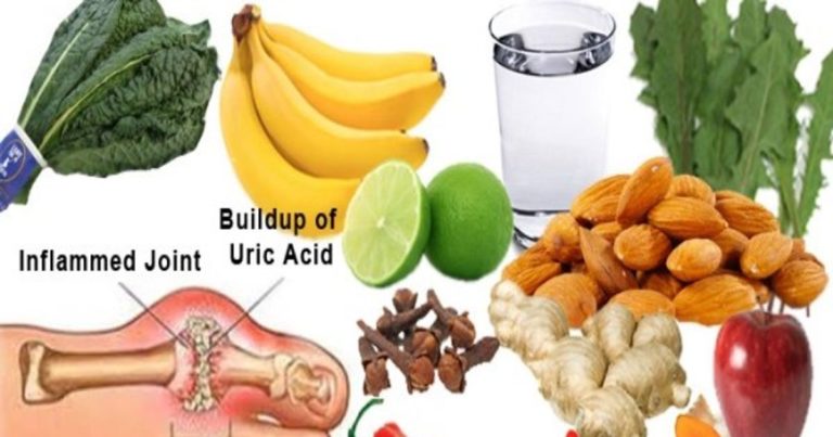 Uric Acid ke Gharelu Nuskhe