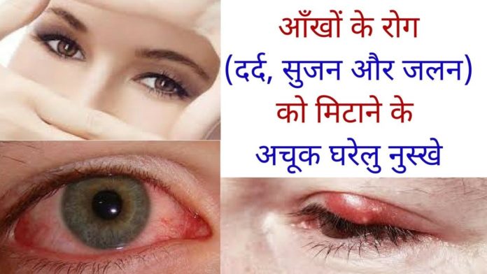 eye care tips